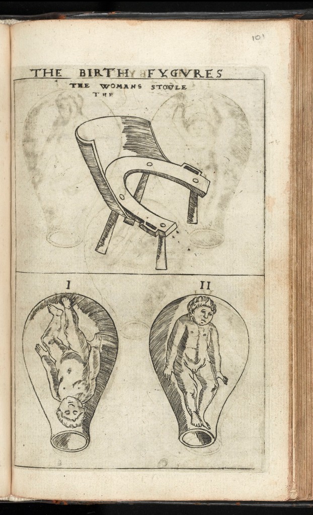16th century birth stool design (similar style to ancient Roman birth stools, though perhaps with the addition of a back), along with two examples of fetal position in the uterus.