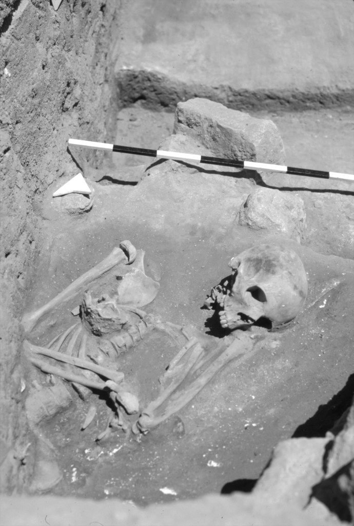 Black and white image of a young female skeleton with obvious staining around the cranium. 