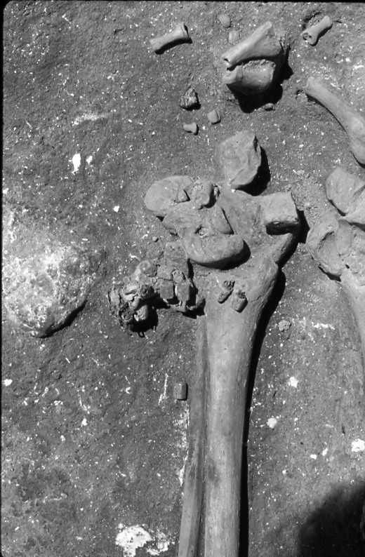 Black and white image of a left ankle of a young woman, with several fragments of ornamental jewellery around it. 